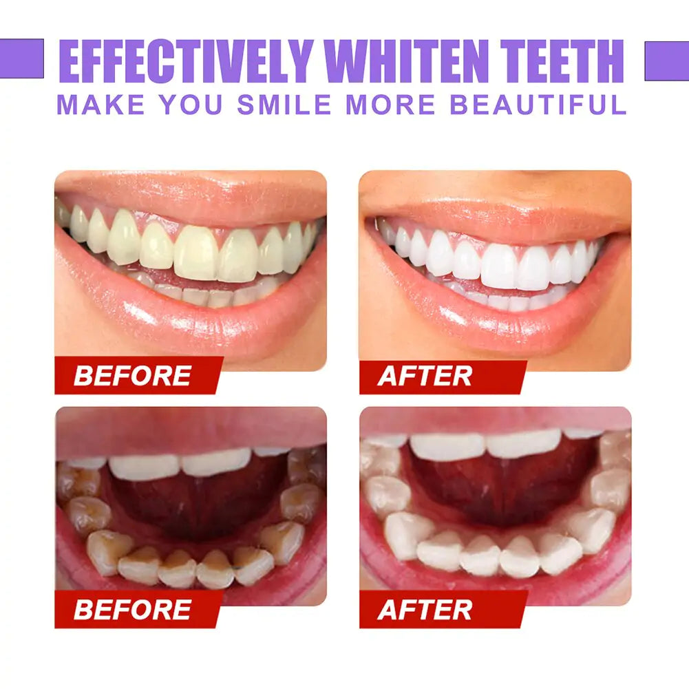 Teeth Colour Corrector Toothpaste